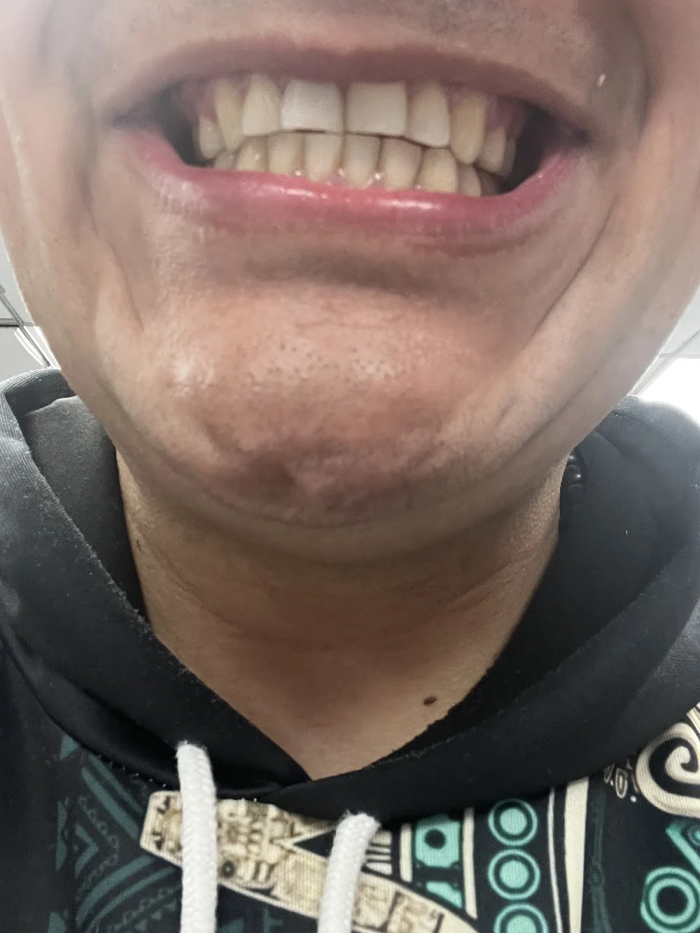 One And Truly Dental Picture 10