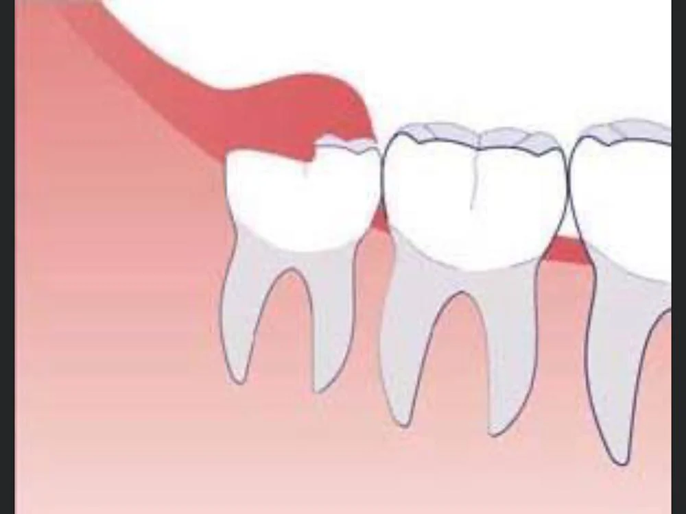 Charles H. Hoffman, DDS Oral and Maxillofacial Surgeon Picture 6