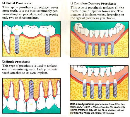 Charles H. Hoffman, DDS Oral and Maxillofacial Surgeon Picture 8