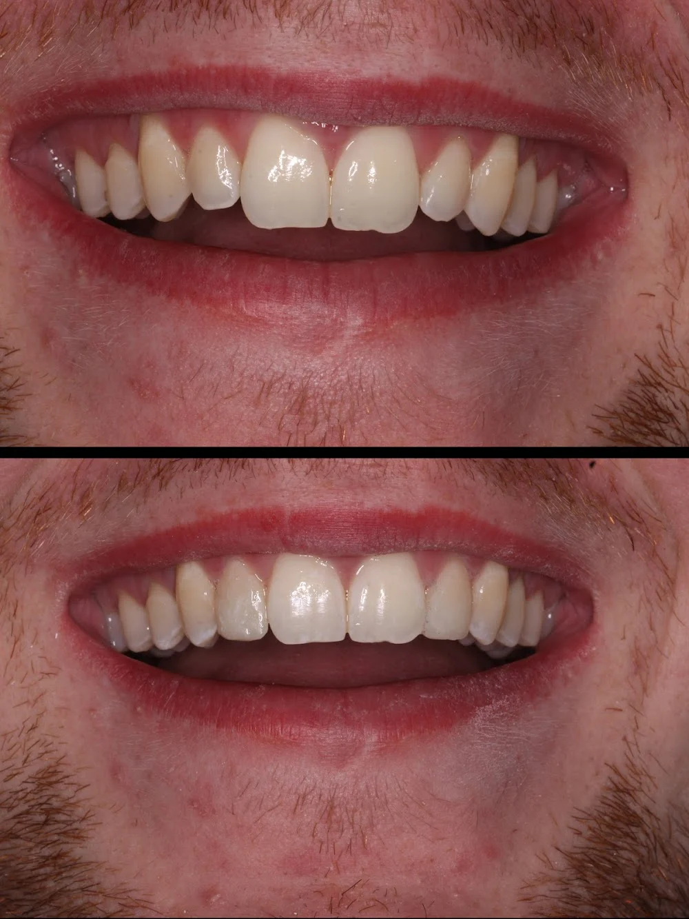 East Hills Dental Associates: Richard A. Sousa, DDS Picture 8