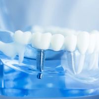 Beyond Periodontics ico