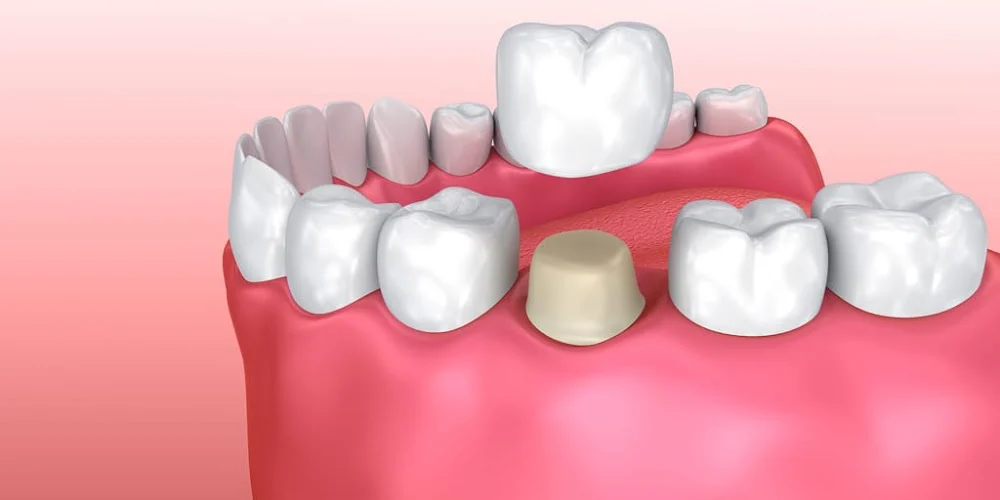 Comprehensive Dentistry Picture 4