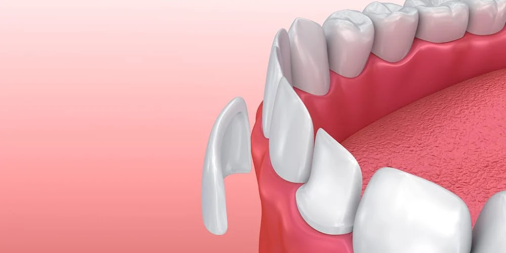 Comprehensive Dentistry Picture 3