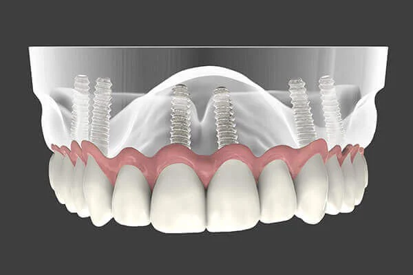 Montclair Perio & Implant Specialists: Anne Hartnett, DDS Picture 1