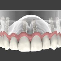 Montclair Perio & Implant Specialists: Anne Hartnett, DDS ico