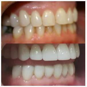 Rockaway Dental Center Picture 8
