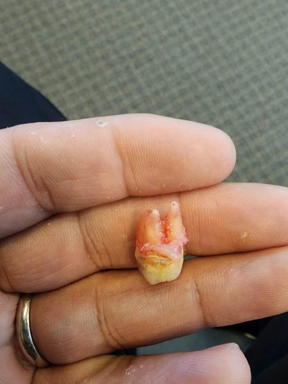 Wayne Valley Dental Care - Nicholas J. Tria, DMD Picture 3