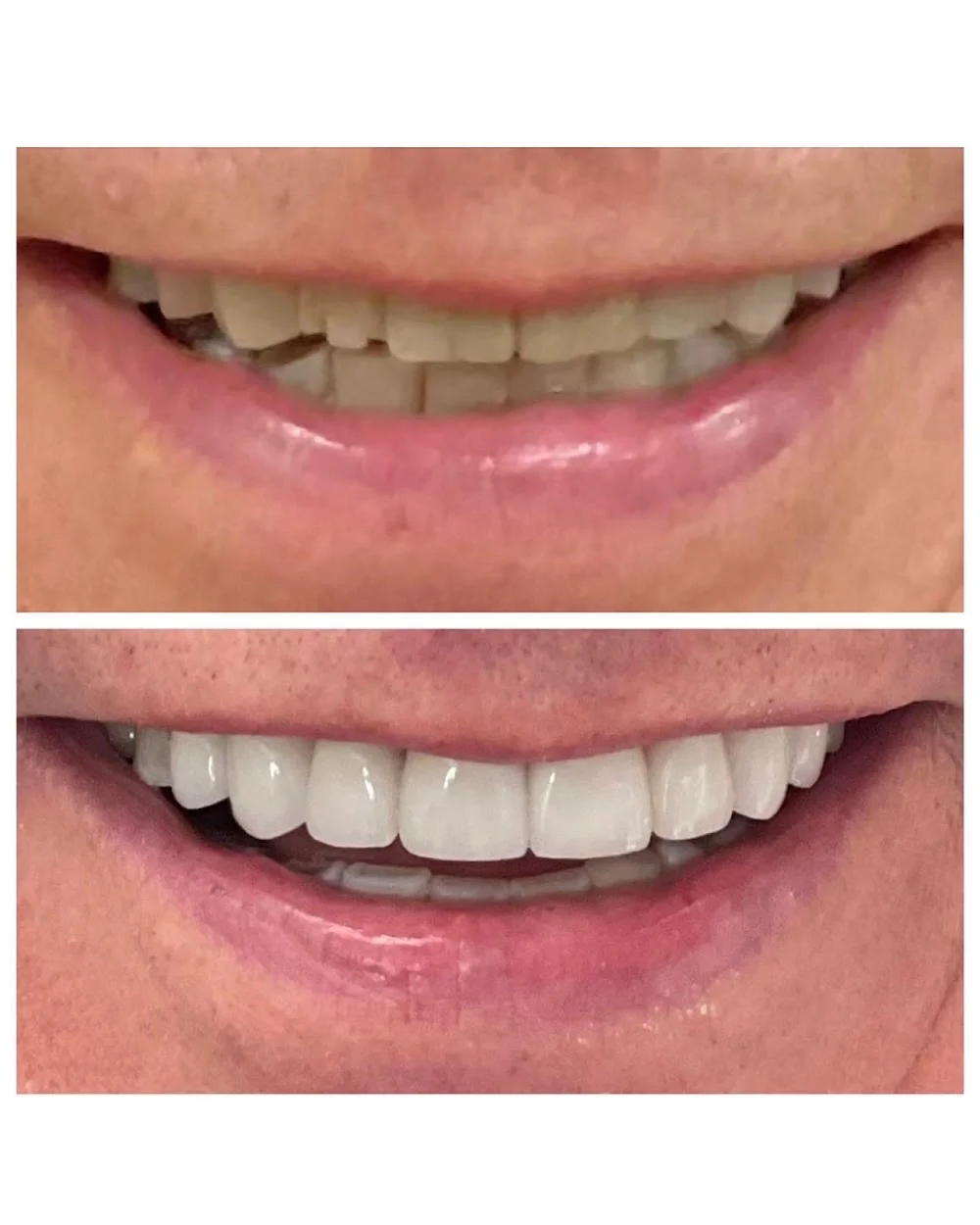 Smilepartnerz Dental Health Group Picture 4