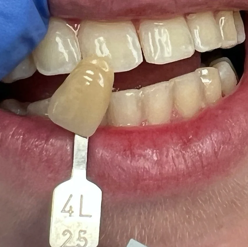Pro Dental - Blaine, MN Picture 4