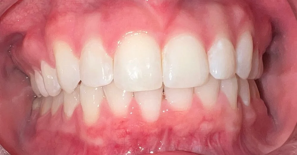 Pro Dental - Blaine, MN Picture 5