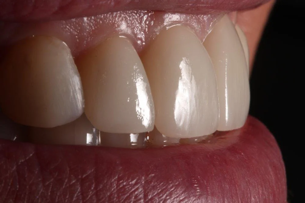Pellegrini Dental Picture 10