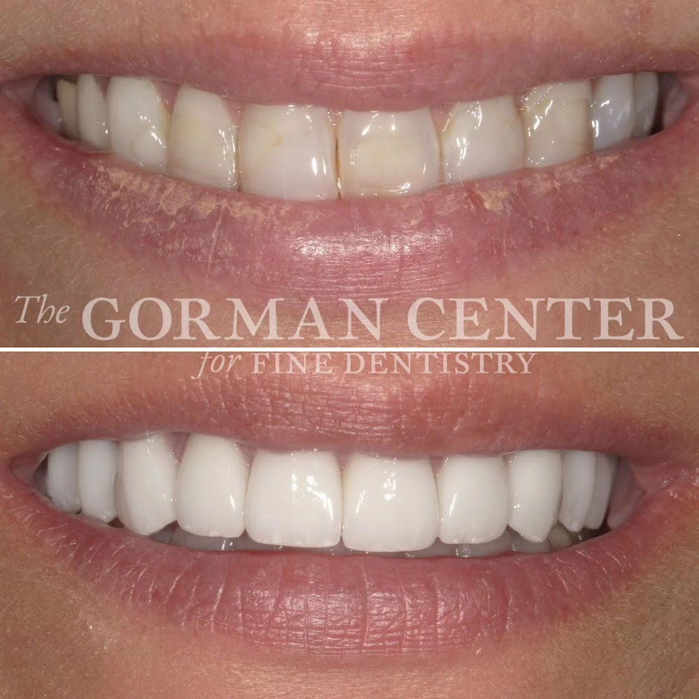 The Gorman Center for Fine Dentistry Picture 8