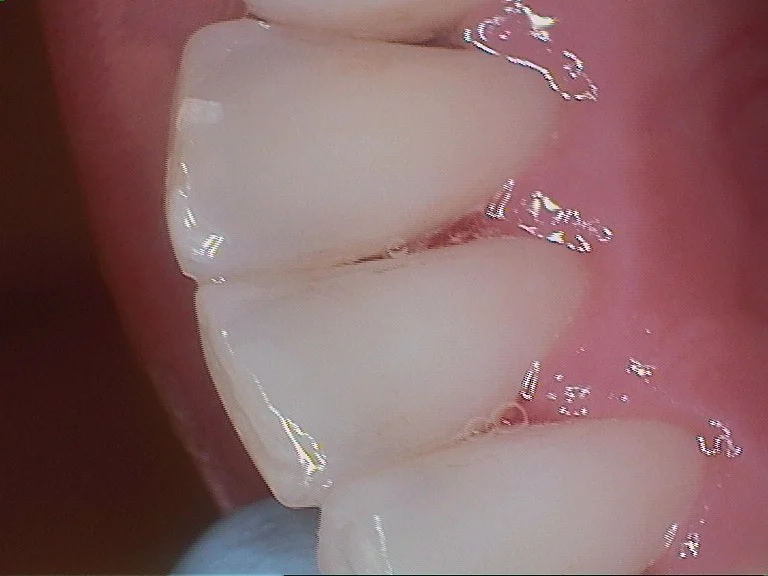 Biologic Dentistry Picture 6