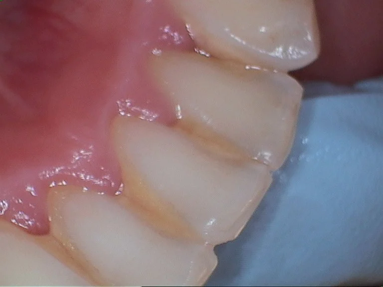Biologic Dentistry Picture 4