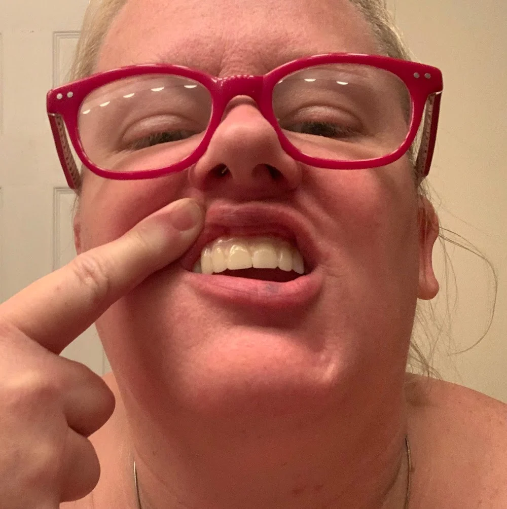 Glee Dental Picture 9