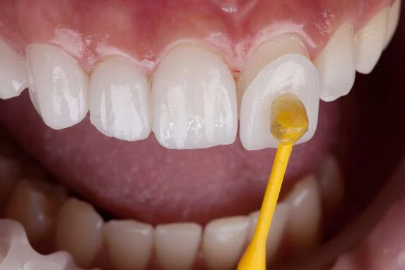 Day and Night Dental Picture 9