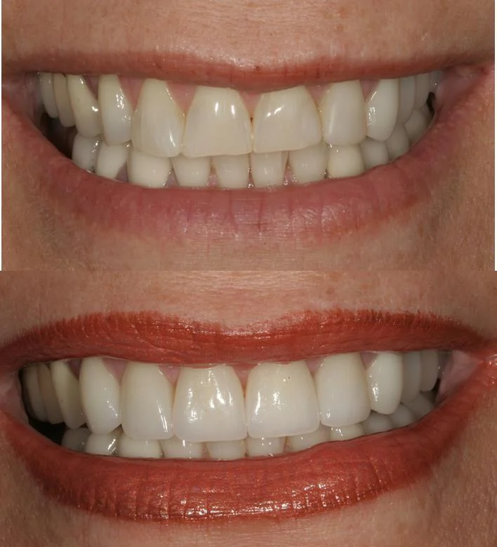 Opus Dental Esthetics: Derek Conover, DMD Picture 6