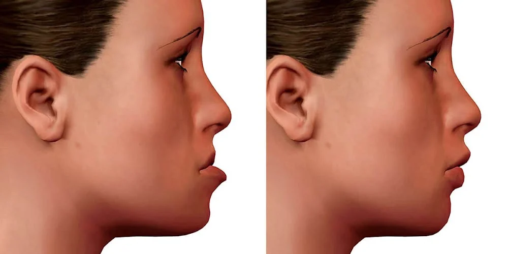 Signature Orthodontics: Wendy Sydlewski, MD, DDS Picture 3