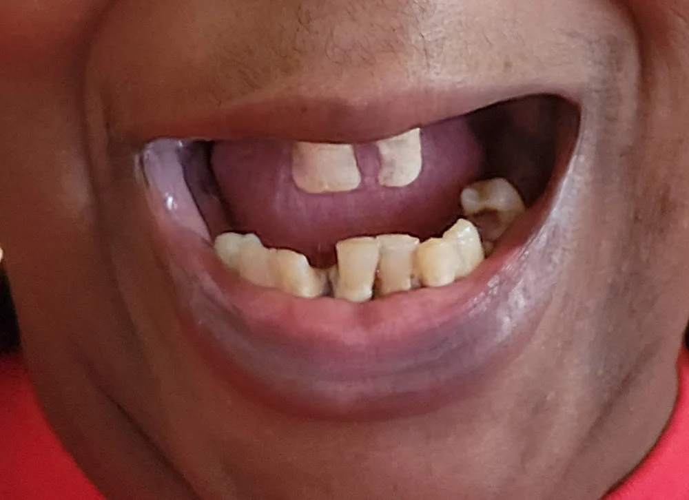 Bala Periodontics and Dental Implants Picture 2