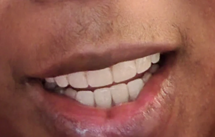 Bala Periodontics and Dental Implants Picture 1