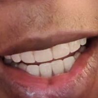 Bala Periodontics and Dental Implants ico