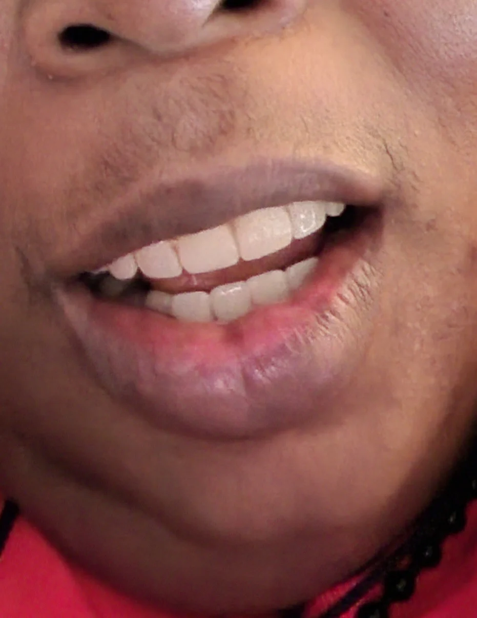 Bala Periodontics and Dental Implants Picture 6