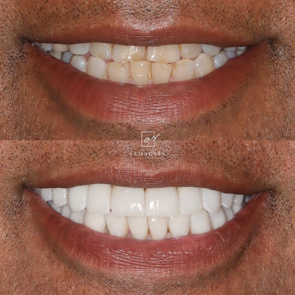 Dr. Amin Samadian Cosmetic & Advanced Dentistry | Dion Health Palo Alto Picture 9