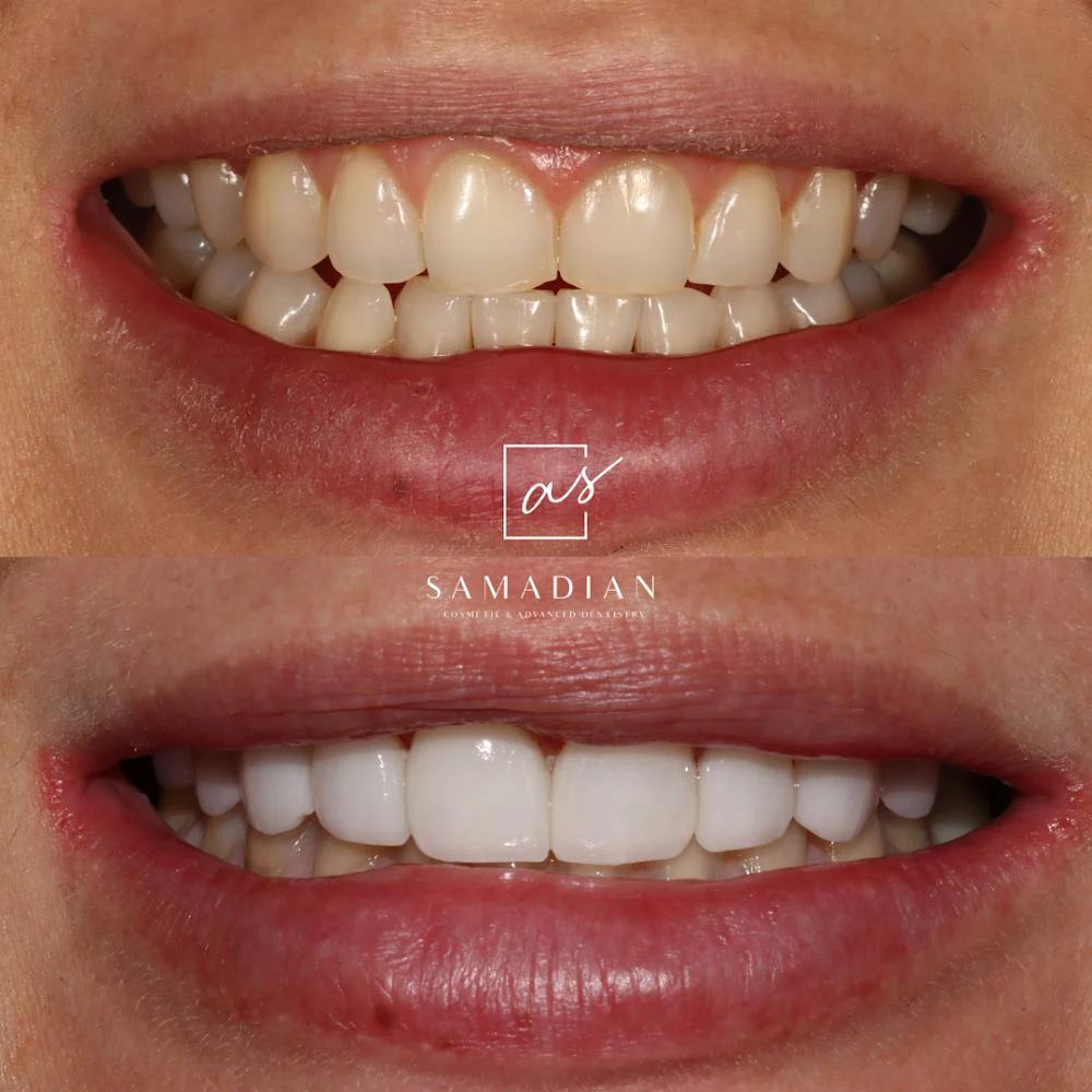 Dr. Amin Samadian Cosmetic & Advanced Dentistry | Dion Health Palo Alto Picture 2