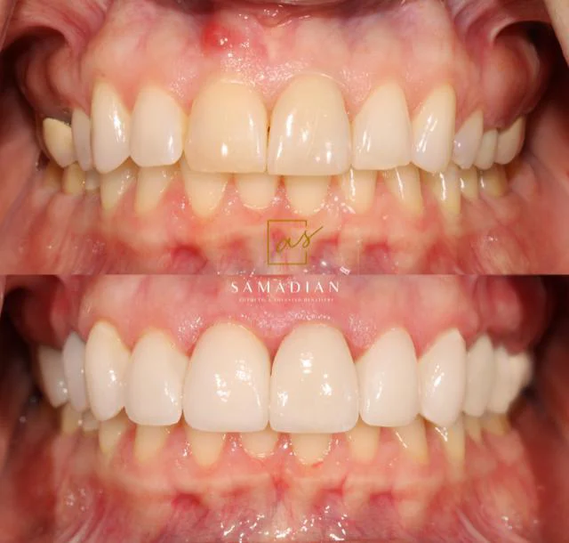 Dr. Amin Samadian Cosmetic & Advanced Dentistry | Dion Health Palo Alto Picture 10