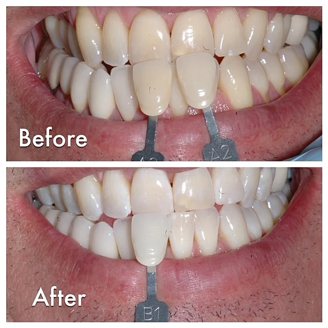Scottsdale Laser Dentistry Picture 8