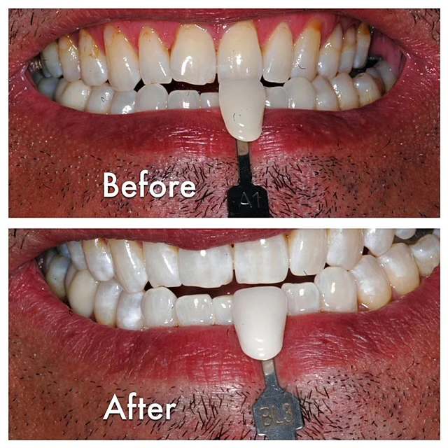 Scottsdale Laser Dentistry Picture 7