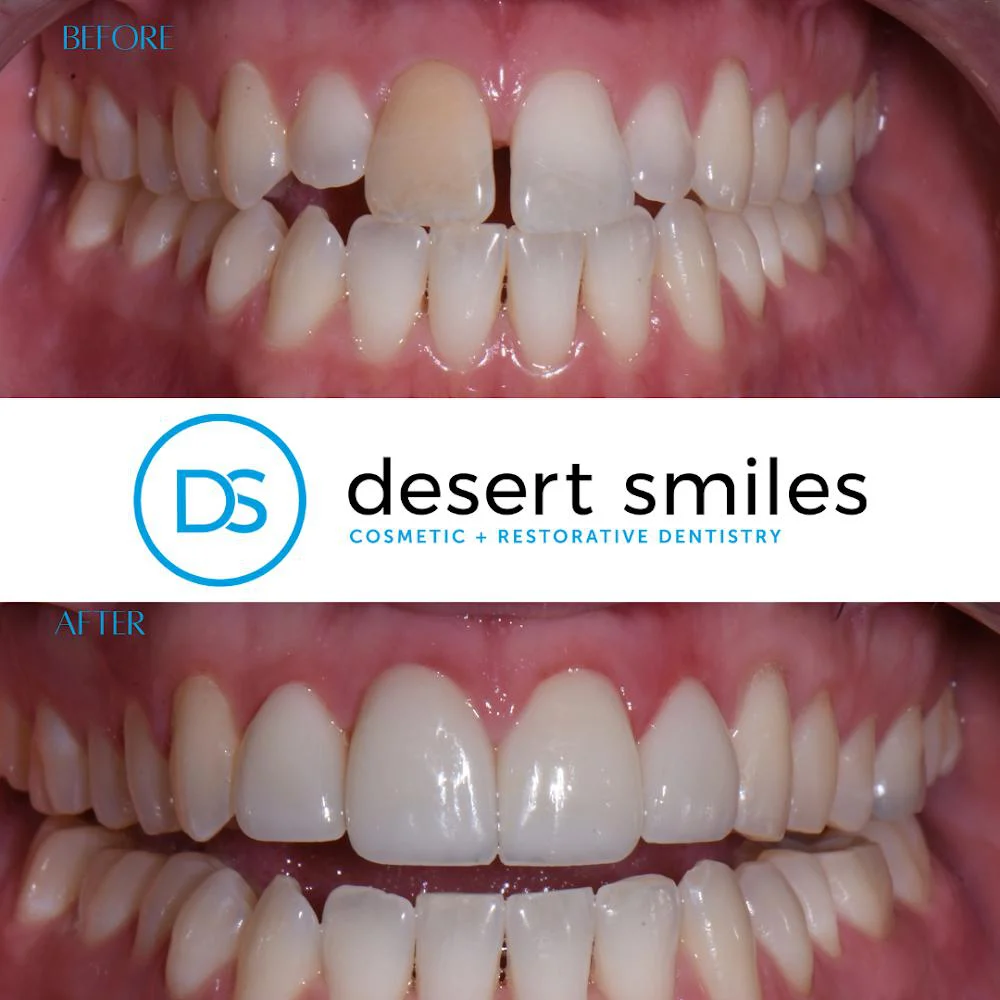 Desert Smiles Cosmetic & Restorative Dentistry Picture 3