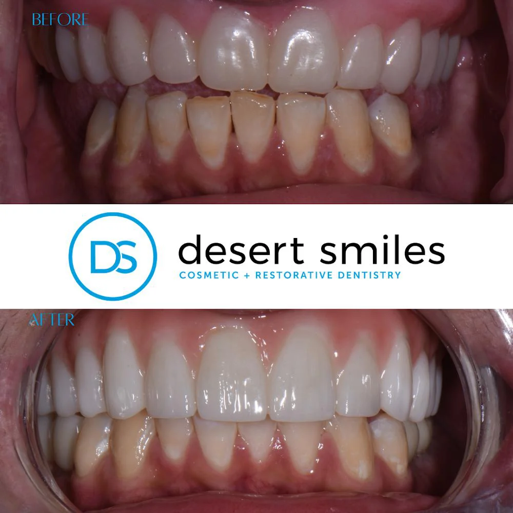 Desert Smiles Cosmetic & Restorative Dentistry Picture 5