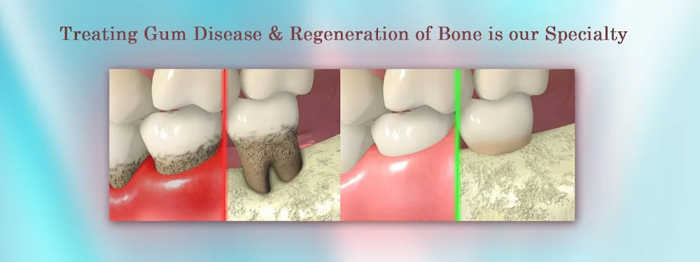 Sam B Khoury DDS MS-Dental Implant & Perio Surgeons Picture 10