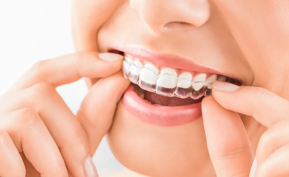 Prince Dental Care Picture 4