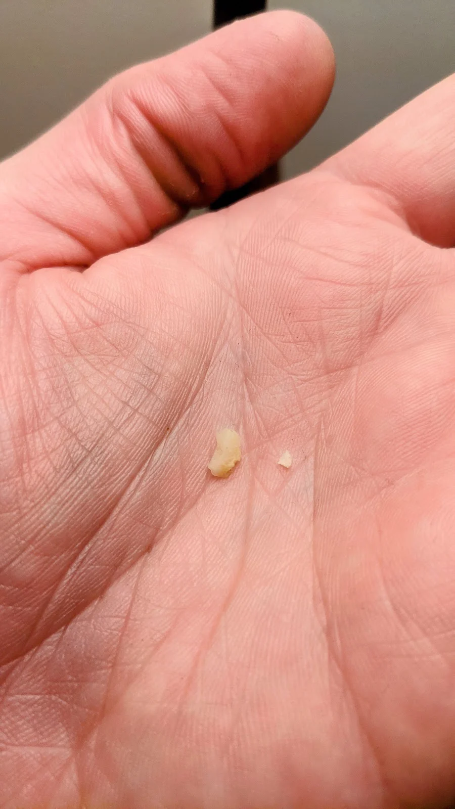 Carp Dental Picture 5