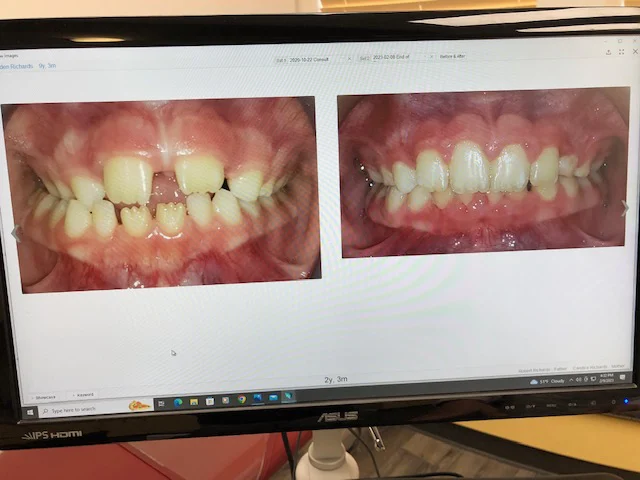 Kate Lembck Orthodontics Picture 1