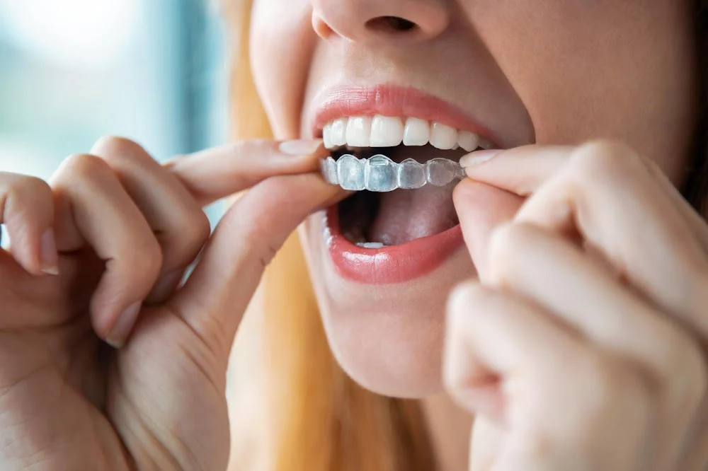 Russell di Bari, DDS - Sunnyvale Cosmetic Dentist Picture 2