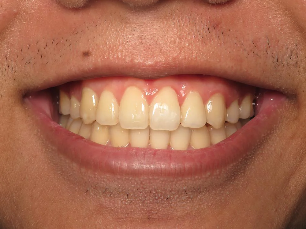 Bittner Family Dental Group Picture 3