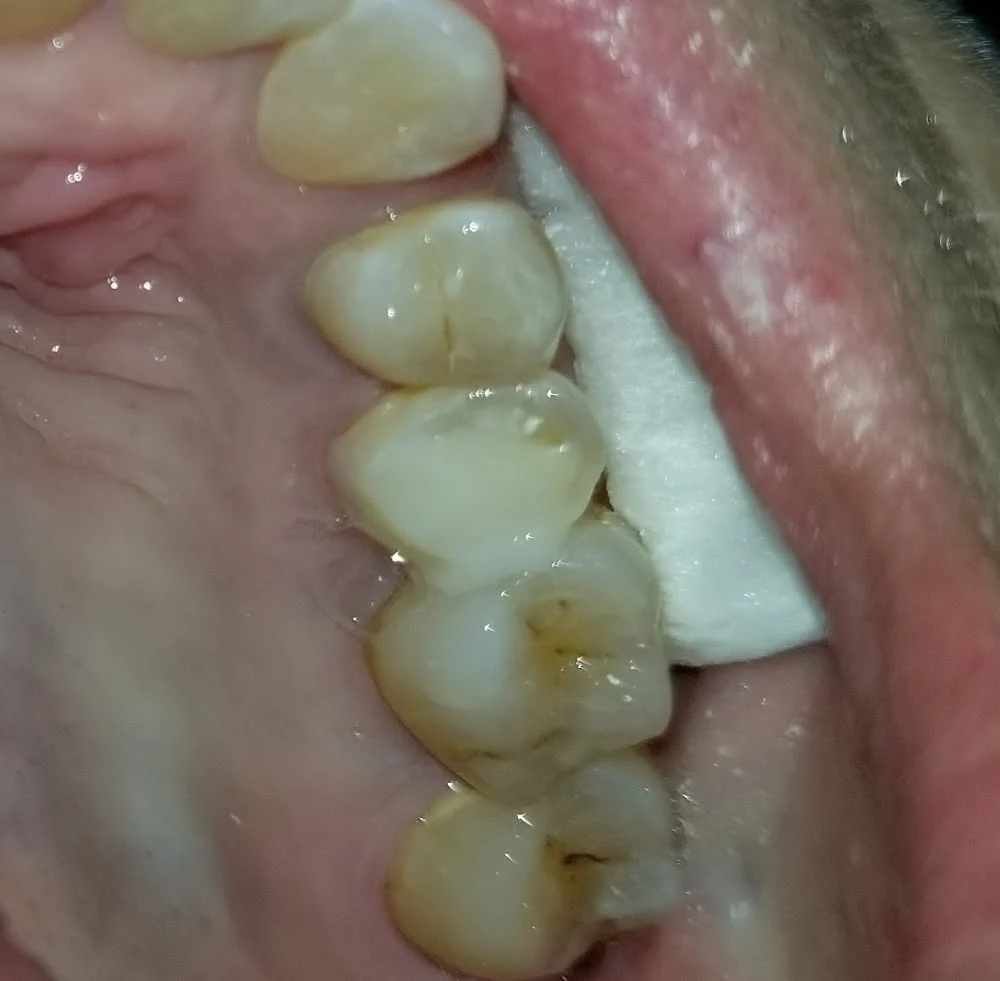 Mirage Dental Care - Dr. Empaljit Singh Gill Picture 2