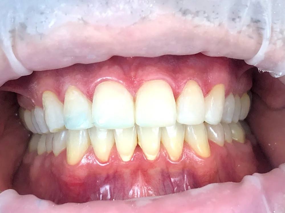 Karin Hatami DDS, SmileXthetics Picture 1