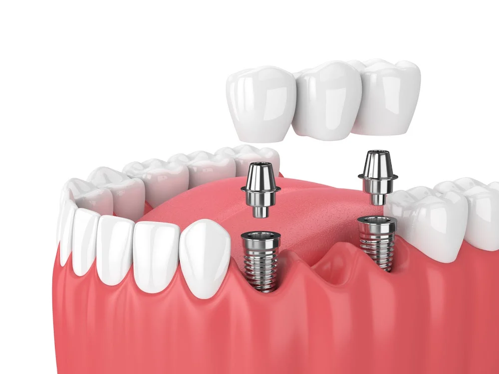 Signature Smiles Dental Picture 7