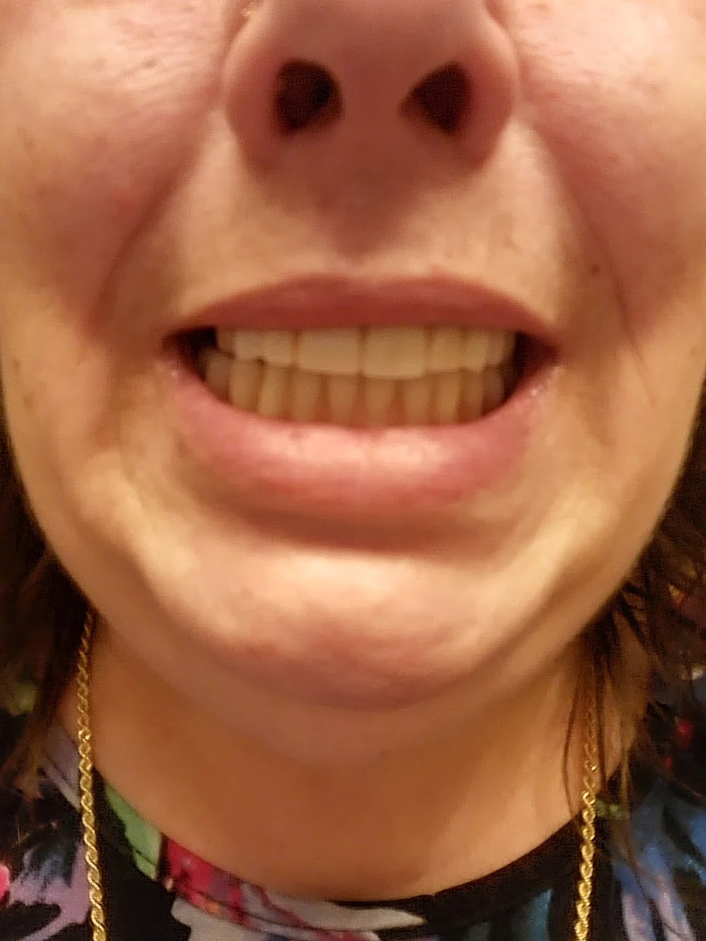 Renaissance Aesthetic Dentistry Picture 3