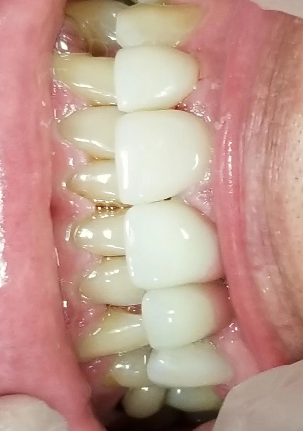 Family Dentistry, Sandip J. Desai DDS, MS Picture 10