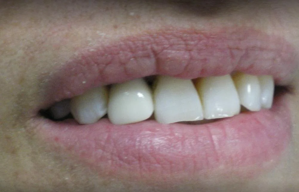 Family Dentistry, Sandip J. Desai DDS, MS Picture 7