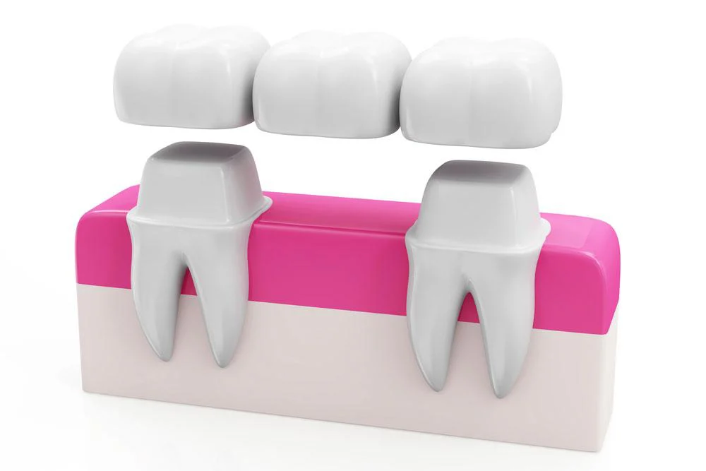 Smile Design Dental Group Picture 8