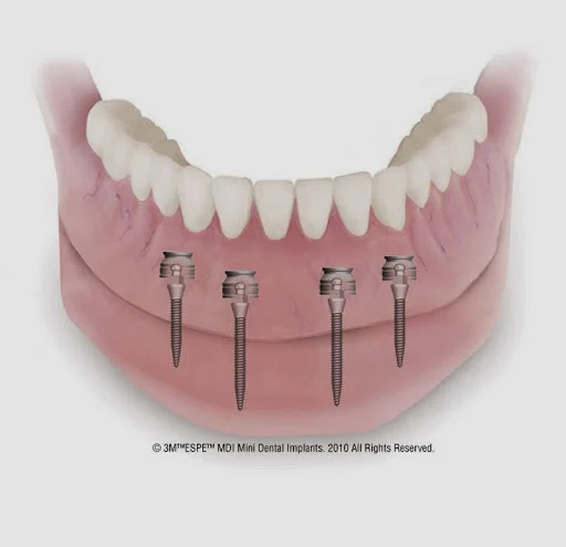 Dr. Flores Family Dental Office Picture 7