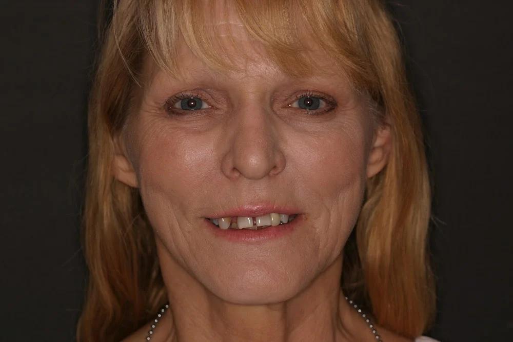 Mission Laser Dentistry | Robert K Faber DDS Inc Picture 9