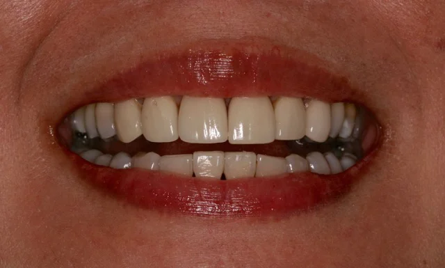 Mission Laser Dentistry | Robert K Faber DDS Inc Picture 5