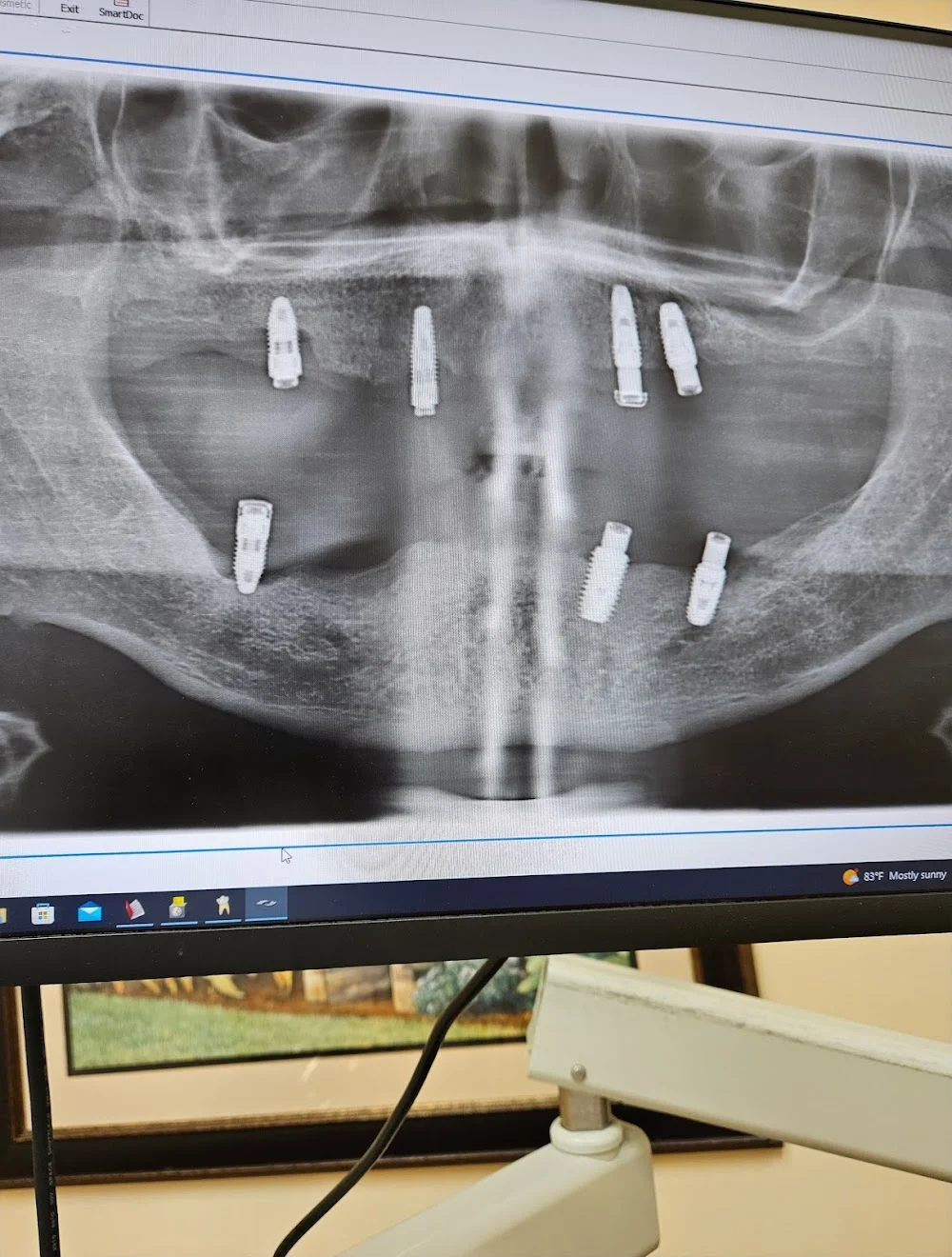 Elegant Dental Care Picture 8